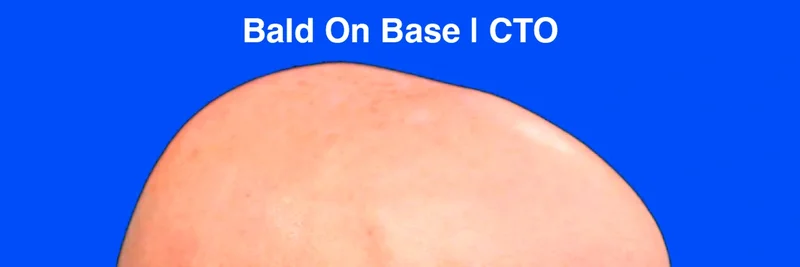 Base의 BALD: 러그풀 역사, 토큰 주소, 2024년 소각 설명